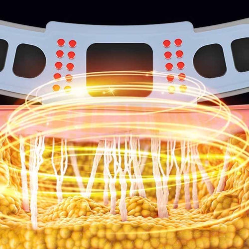 VONMIE Fifth Generation EMS Microcurrent Photon Rejuvenation Plastic Belt  (Ready Stock)