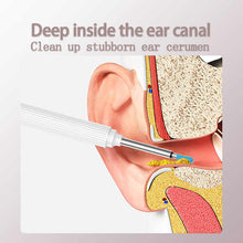 Load image into Gallery viewer, *Donut Offer* Smart Visual Ear Cleaner Camera – Ear Wax Removal Device - Searching C Malaysia